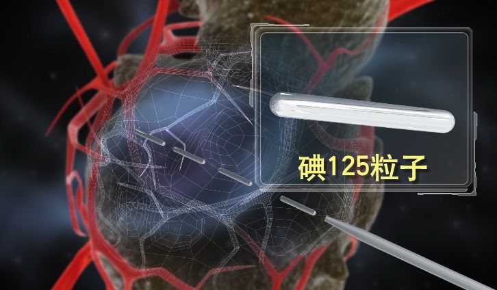 圖片1、小粒子，大能量.jpeg